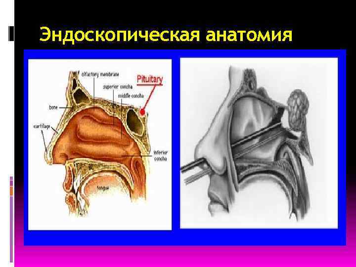 Эндоскопическая анатомия 