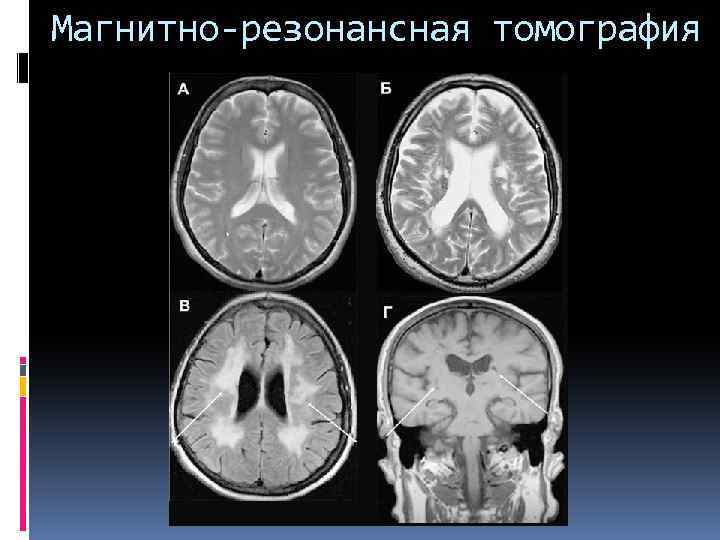 Магнитно-резонансная томография 