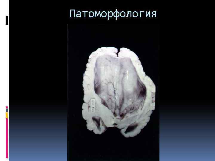 Патоморфология 