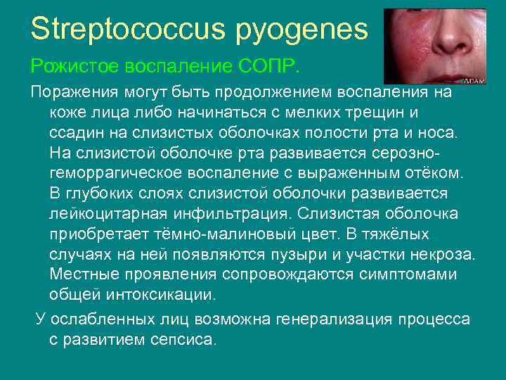 Streptococcus pyogenes Рожистое воспаление СОПР. Поражения могут быть продолжением воспаления на коже лица либо