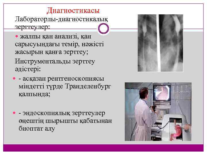 Диагностикасы Лабораторлы диагностикалық зерттеулер: жалпы қан анализі, қан сарысуындағы темір, нәжісті жасырын қанға зерттеу;