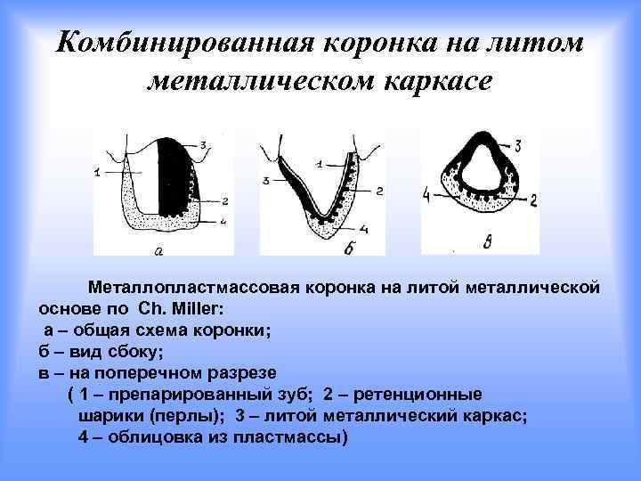 Современные компьютерные технологии ортопедического лечения дефектов коронок зубов презентация