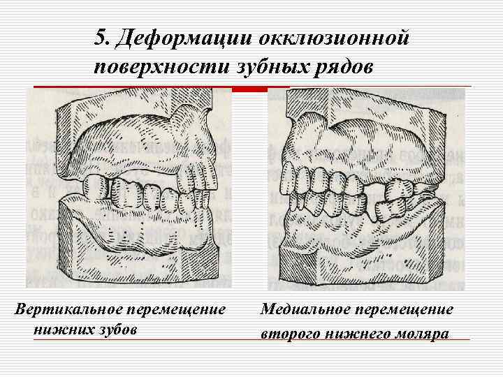 Форма зубных рядов