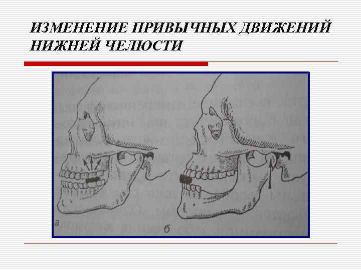 Клиническая картина частичного отсутствия зубов