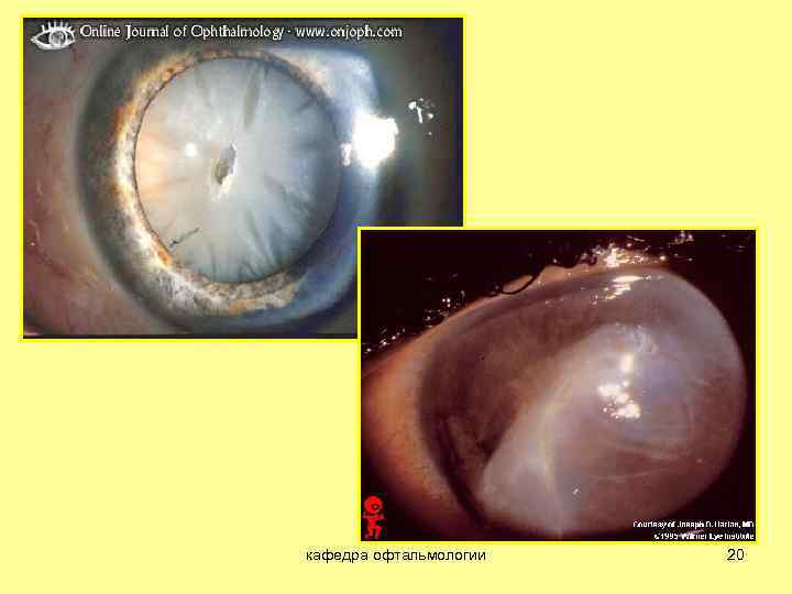 кафедра офтальмологии 20 
