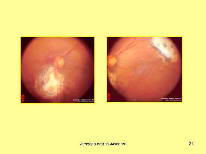 кафедра офтальмологии 31 