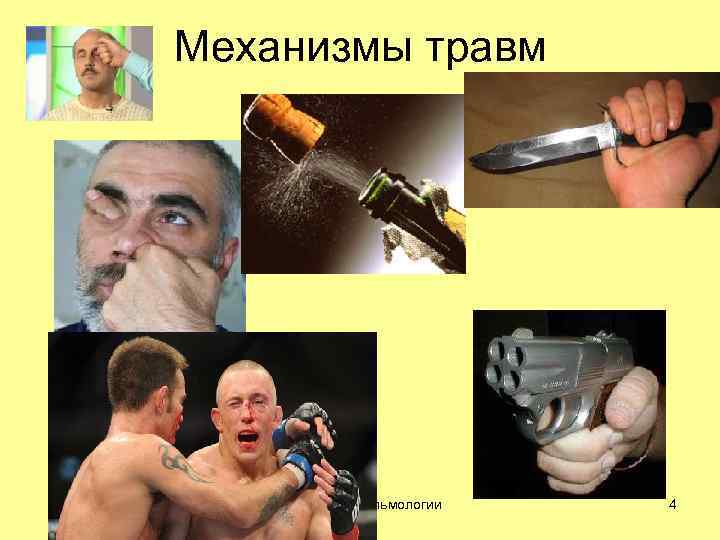 Механизмы травм кафедра офтальмологии 4 