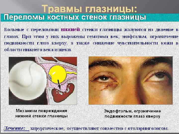 Травмы глазницы: 