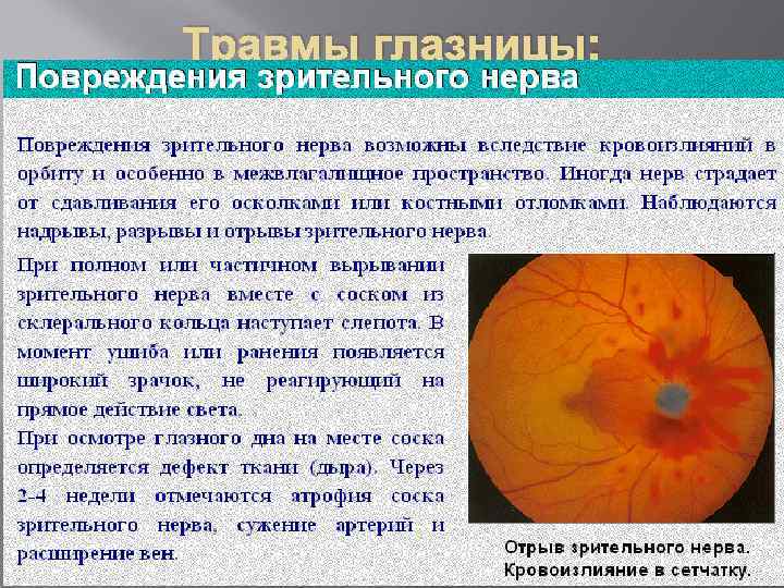 Травмы глазницы: 