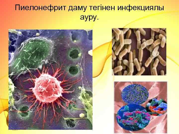 Пиелонефрит даму тегінен инфекциялы ауру. 