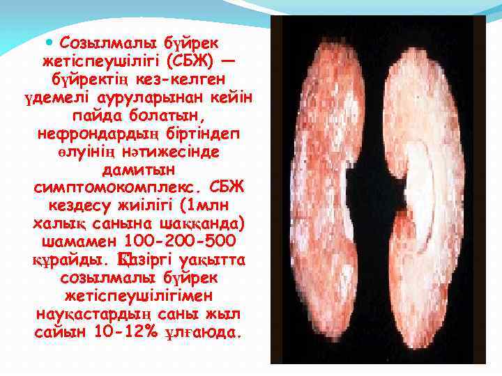 Созылмалы жүрек жетіспеушілігі презентация