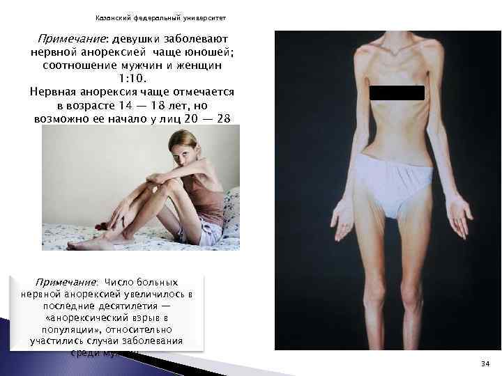 Казанский федеральный университет Примечание: девушки заболевают нервной анорексией чаще юношей; соотношение мужчин и женщин