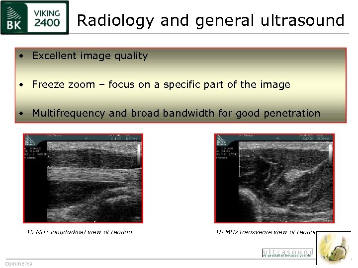Radiology and general ultrasound • Excellent image quality • Freeze zoom – focus on