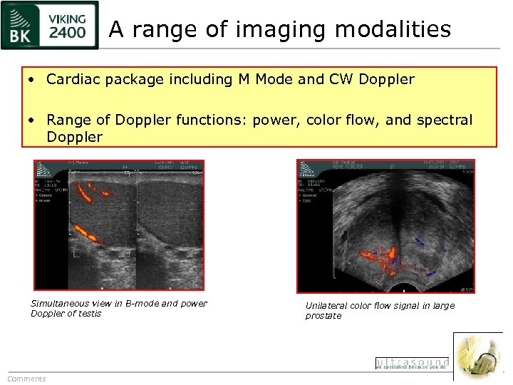 A range of imaging modalities • Cardiac package including M Mode and CW Doppler