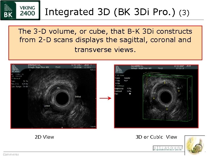 Integrated 3 D (BK 3 Di Pro. ) (3) The 3 -D volume, or