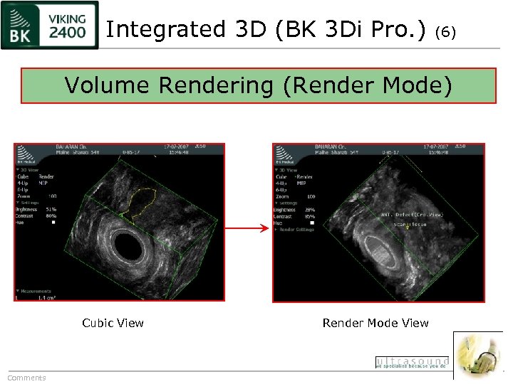 Integrated 3 D (BK 3 Di Pro. ) (6) Volume Rendering (Render Mode) Cubic