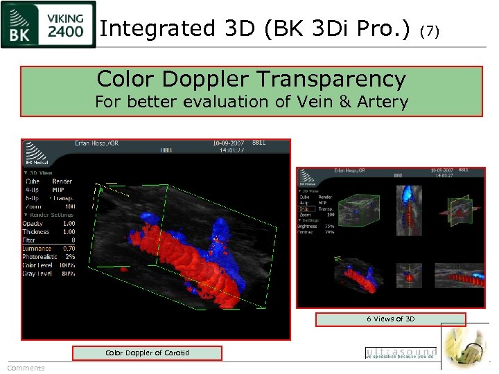Integrated 3 D (BK 3 Di Pro. ) Color Doppler Transparency For better evaluation