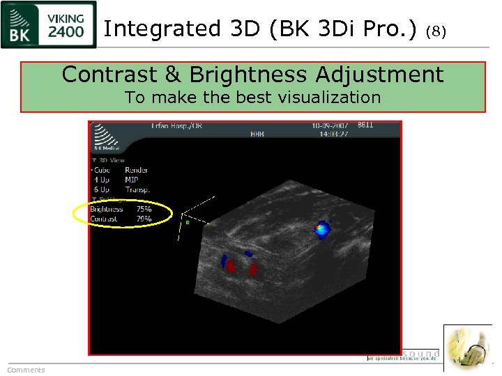 Integrated 3 D (BK 3 Di Pro. ) (8) Contrast & Brightness Adjustment To