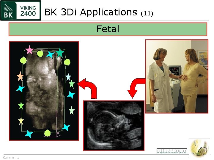 BK 3 Di Applications Fetal Comments (11) 
