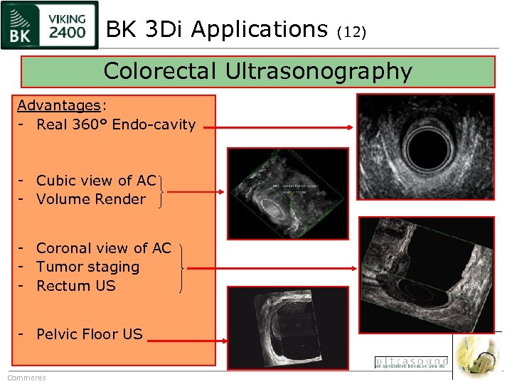 BK 3 Di Applications (12) Colorectal Ultrasonography Advantages: - Real 360° Endo-cavity - Cubic