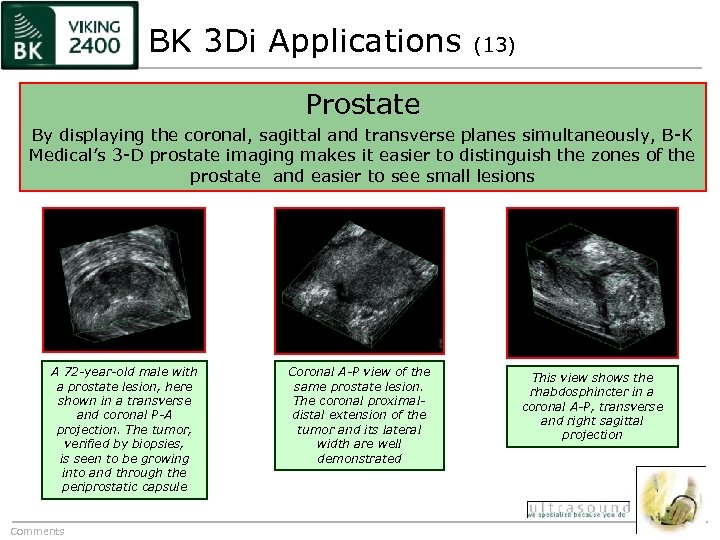 BK 3 Di Applications (13) Prostate By displaying the coronal, sagittal and transverse planes
