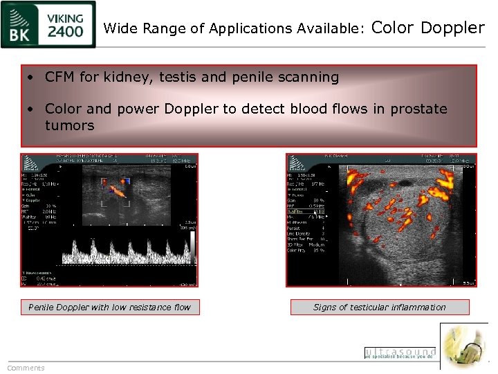 Wide Range of Applications Available: Color Doppler • CFM for kidney, testis and penile