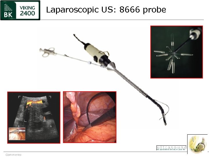 Laparoscopic US: 8666 probe Comments 