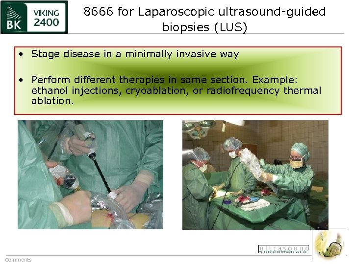 8666 for Laparoscopic ultrasound-guided biopsies (LUS) • Stage disease in a minimally invasive way