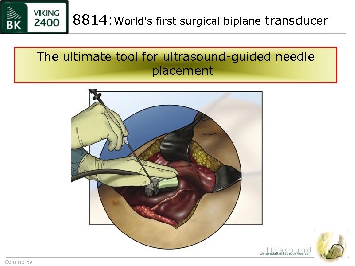 8814: World's first surgical biplane transducer The ultimate tool for ultrasound-guided needle placement Comments