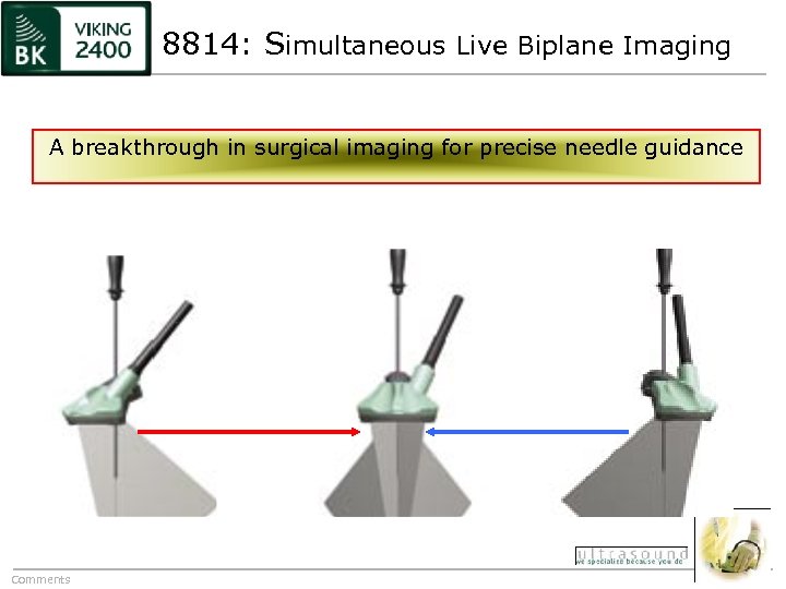 8814: Simultaneous Live Biplane Imaging A breakthrough in surgical imaging for precise needle guidance