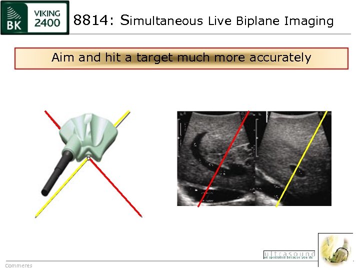8814: Simultaneous Live Biplane Imaging Aim and hit a target much more accurately Comments