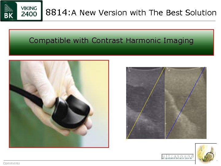 8814: A New Version with The Best Solution Compatible with Contrast Harmonic Imaging Comments