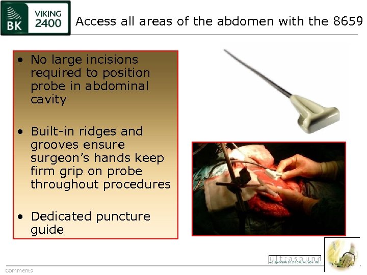 Access all areas of the abdomen with the 8659 • No large incisions required