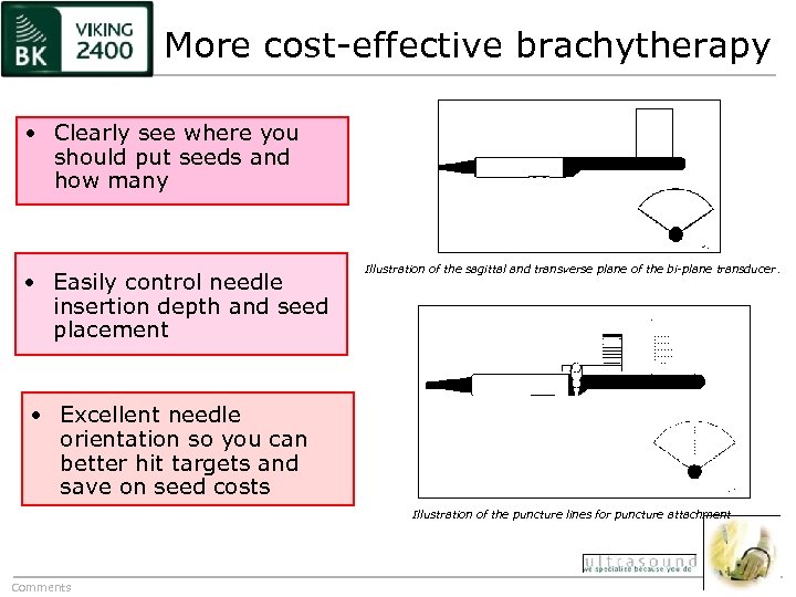 More cost-effective brachytherapy • Clearly see where you should put seeds and how many