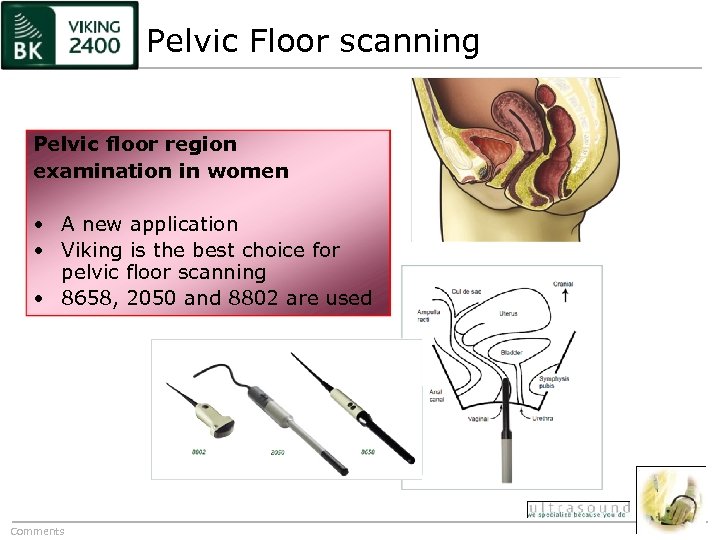 Pelvic Floor scanning Pelvic floor region examination in women • A new application •