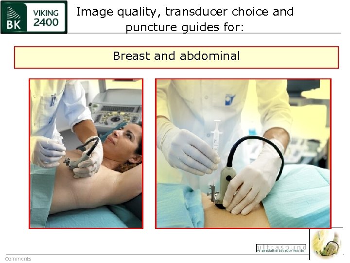 Image quality, transducer choice and puncture guides for: Breast and abdominal Comments 