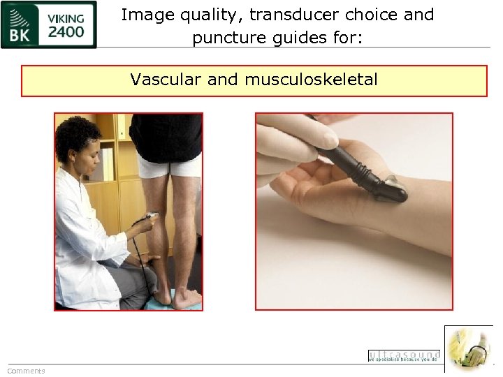 Image quality, transducer choice and puncture guides for: Vascular and musculoskeletal Comments 