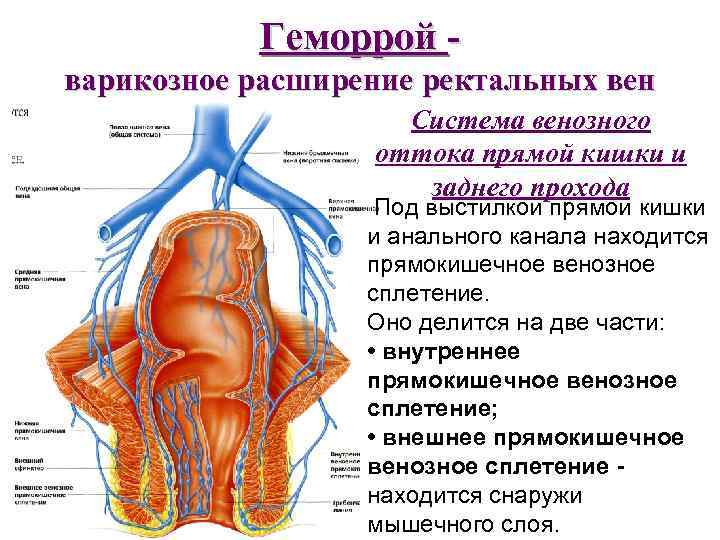 Геморрой варикозное расширение ректальных вен Система венозного оттока прямой кишки и заднего прохода Под