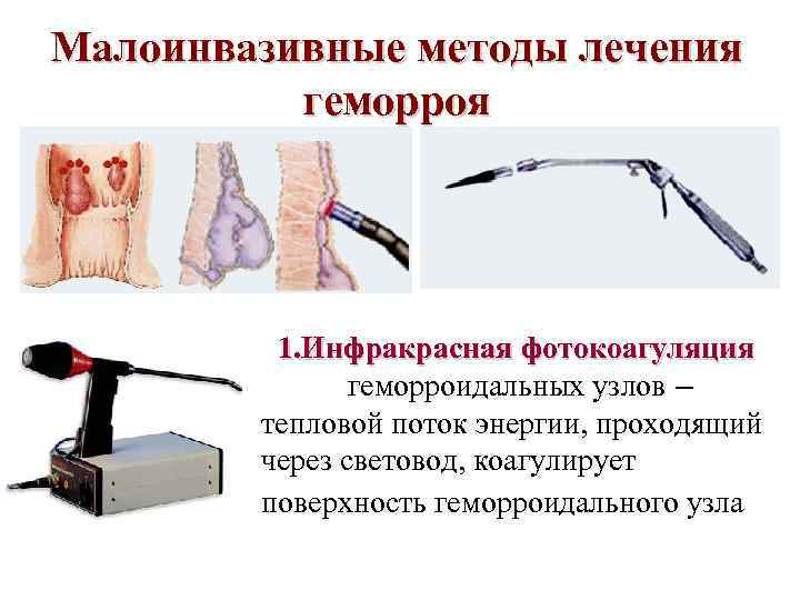 Заболевания прямой кишки факультетская хирургия презентация