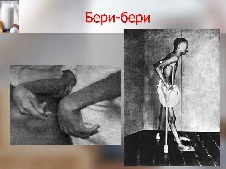 Бери-бери 