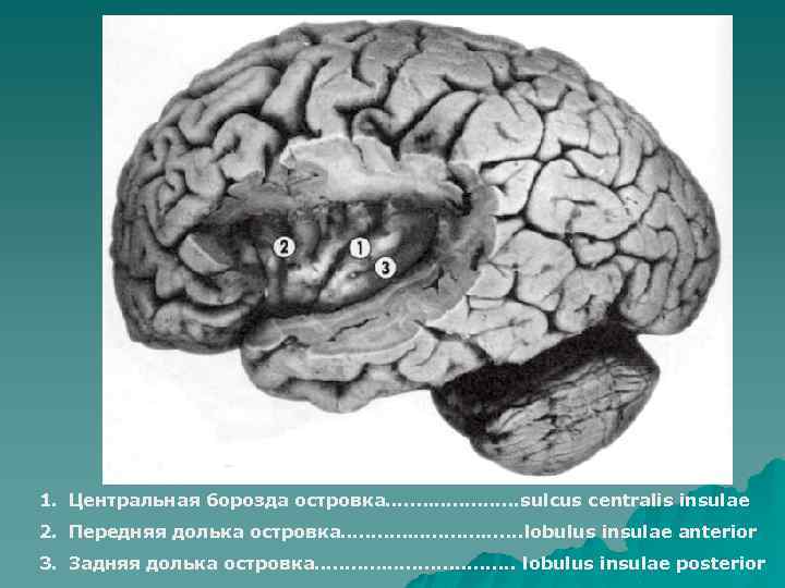 1. Центральная борозда островка…. . ……sulcus centralis insulae 2. Передняя долька островка…………. . ….