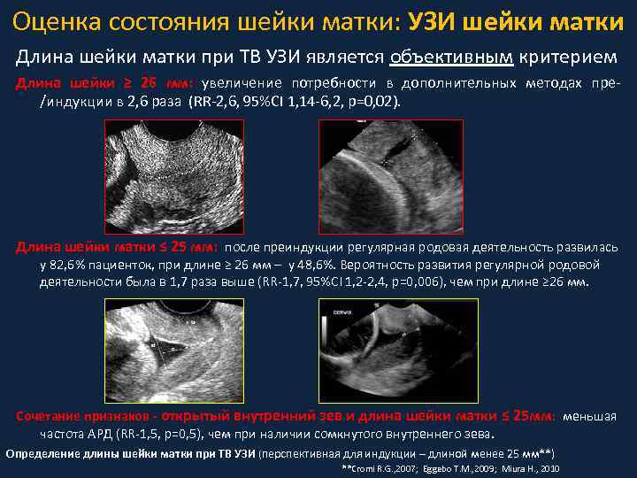 Оценка состояния шейки матки: УЗИ шейки матки Длина шейки матки при ТВ УЗИ является