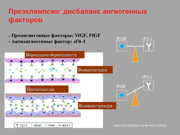 Преэклампсия: дисбаланс ангиогенных факторов - Проангиогенные факторы: Vl. GF, Pl. GF - Антиангиогенные фактор: