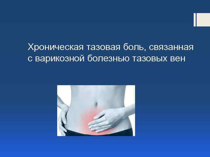 Хроническая тазовая боль, связанная с варикозной болезнью тазовых вен 