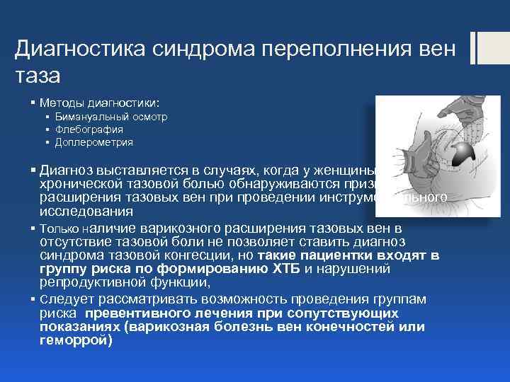 Диагностика синдрома переполнения вен таза § Методы диагностики: § Бимануальный осмотр § Флебография §