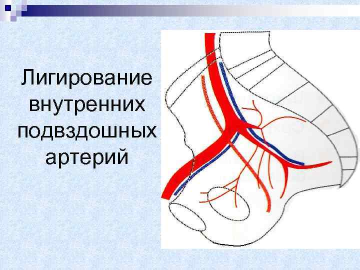 Подвздошная артерия