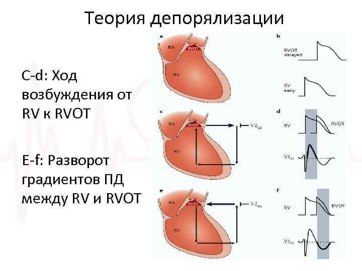 Теория депорялизации C-d: Ход возбуждения от RV к RVOT E-f: Разворот градиентов ПД между