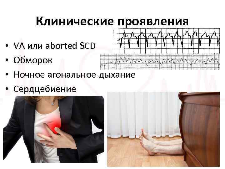 Клинические проявления • • VA или aborted SCD Обморок Ночное агональное дыхание Сердцебиение 