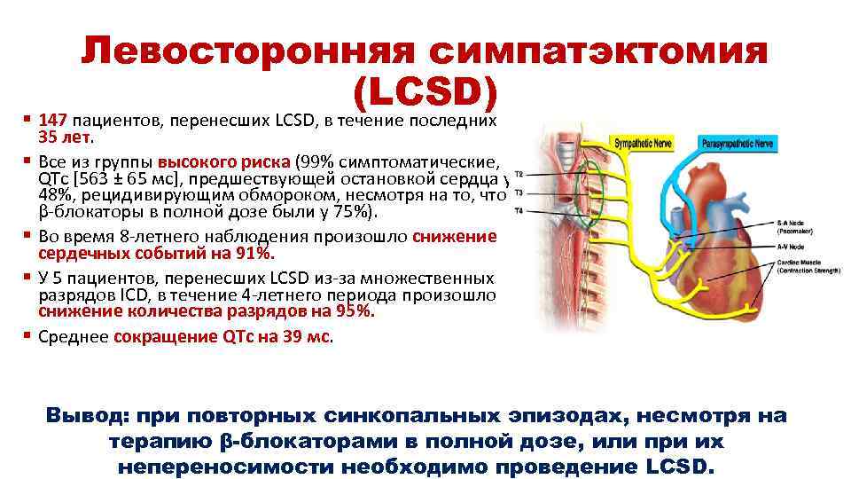 Левосторонняя симпатэктомия (LCSD) § 147 пациентов, перенесших LCSD, в течение последних 35 лет. §