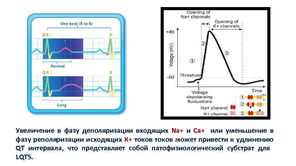 Удлинение qt. Синдром удлиненного интервала qt этиология. Синдром укороченного интервала qt. Критерии синдрома удлиненного интервала qt. Удлинение интервала qt корригированный у детей.